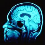brain